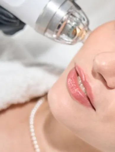 ダーマペン4（顔/ヴェルベットスキン）