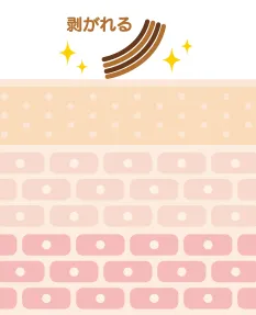 かさぶたになったシミは剥がれ落ちる