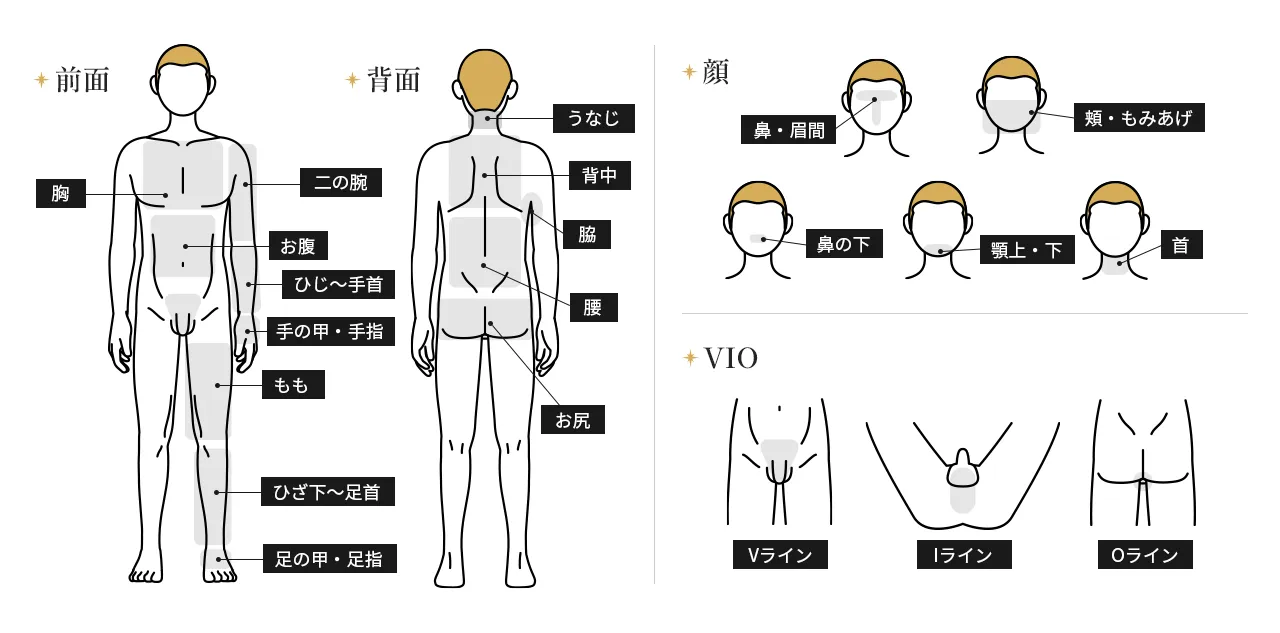 全身＋VIO＋顔（うなじ・指先含む）都度払い75,930円(税込)