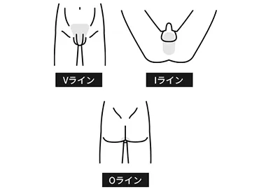 VIO都度払い18,650円(税込)